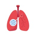 Tuberculosis disease concept. Vector flat healthcare illustration. Red infected lung with bacteria isolated on white background.