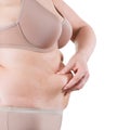 Tummy tuck, flabby skin on a fat belly, plastic surgery concept