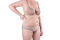 Tummy tuck, flabby skin on a fat belly, plastic surgery concept Royalty Free Stock Photo