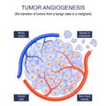 Tumor angiogenesis