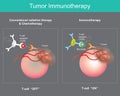 Tumor Immunotherapy. Cancer treatment