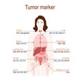 Tumor marker or biomarker. silhouette of a woman with internal o