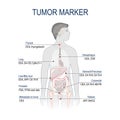 Tumor marker or biomarker. Royalty Free Stock Photo