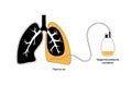 Tunneled pleural catheter