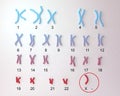 Turner s-syndrome karyotype Royalty Free Stock Photo