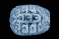 Turtle shell x-ray