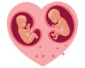 Twin embryos in mother\'s heart. Fetal development during pregnancy. Illustration vector