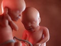 Twin fetuses - week 30