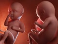 Twin fetuses - week 34 Royalty Free Stock Photo