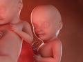 Twin fetuses - week 32