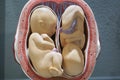 Twins Embryo model, fetus for classroom education.