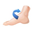 Twisted Foot- Ankle Sprain - Illustration