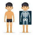 Two Cartoon Style Boy with X-ray Screen and Skeleton. Vector