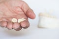 Two extracted wisdom teeth on dentist palm