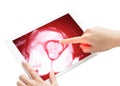 Two hands interact with a tablet screen displaying an MRI image of the heart, vividly highlighted in red to emphasize cardiac