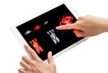 Two hands interact with a tablet screen displaying PET scan images, highlighting metabolic activity in bright red and yellow