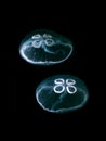 Moon Jellyfish underwater in the dark water of Loch Sween, SCotland