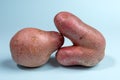 Two non-standard ugly fresh raw potato unusual form lying closely on light blue background. Waste zero food. Close-up