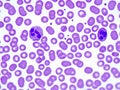 Two segmented neutrophil granulocytes in a blood smear under the microscope