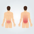 Two silhouettes of men from the back: increased back pain.