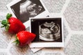 Two strawberry and a photo of a human fetus from an ultrasound scan during pregnancy on a gray background
