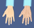 Two types of hand , old and young, vector illustration Royalty Free Stock Photo