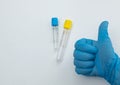 Two vacuum tubes for collection and blood samples with sodium citrate in blue gloves for laboratory. Royalty Free Stock Photo