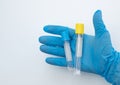 Two vacuum tubes for collection and blood samples in blue gloves. Royalty Free Stock Photo