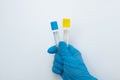 Two vacuum tubes for collection and blood samples with sodium citrate in blue gloves for laboratory. Royalty Free Stock Photo