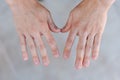 Two young man hands with ugly and bitten fingernails