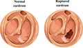 Tympanic membrane