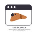 Type of cancer liver vector concept