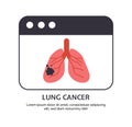 Type of cancer lungs vector concept