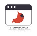 Type of cancer stomach vector concept
