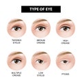 Type of eyelid crease