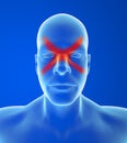 Type headache: Sinus