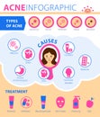 Types of acne, causes of the disease, treatment. Infographics of acne. Royalty Free Stock Photo