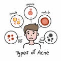 Type of acne , Cute man cartoon face illustration