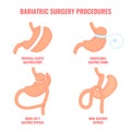 Bariatric surgery weight loss procedures medical infographics