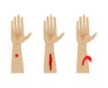 Types of bleeding. Vector Illustration