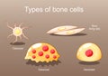 Types of bone cells. Osteocyte, lining cells, osteoblast, osteoclast Royalty Free Stock Photo