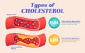 Types of cholesterol comparison with HDL and LDL Royalty Free Stock Photo