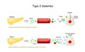 Types 2 of Diabetes Mellitus. Comparison of cell work in diabetes and in a healthy body