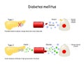 Types of diabetes mellitus