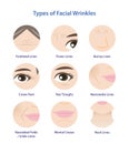 Types of facial wrinkles vector icon set illustration isolated on white background.