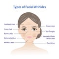 Types of facial wrinkles on woman face vector illustration isolated on white background.