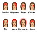 Types of headache illustrated on a woman face