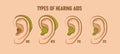 Types of hearing aids.