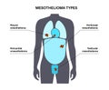 Mesothelioma tumor types