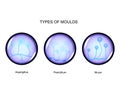 Types of mold